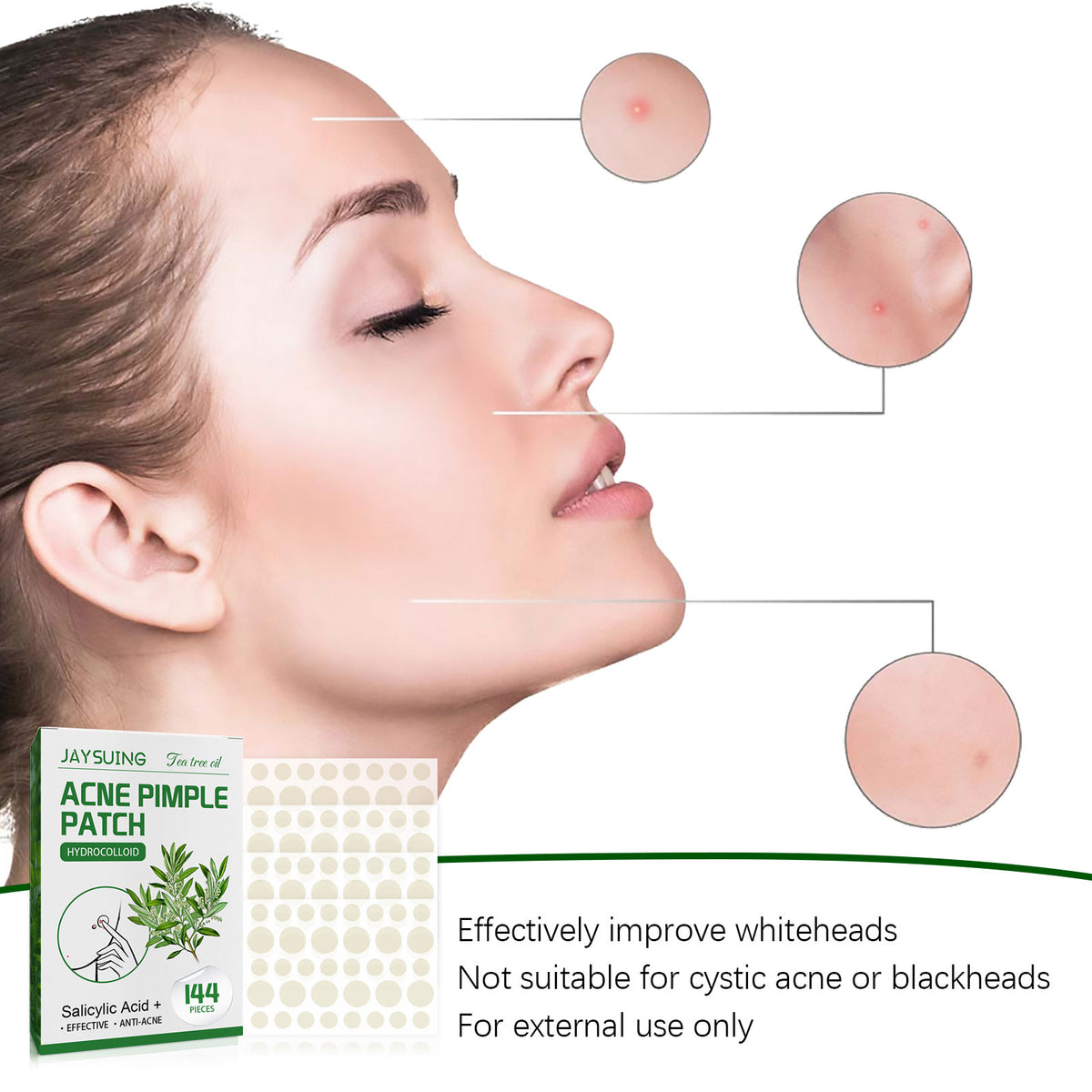 Pimple patch ingredients