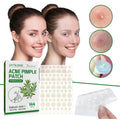 144-count pimple patches
