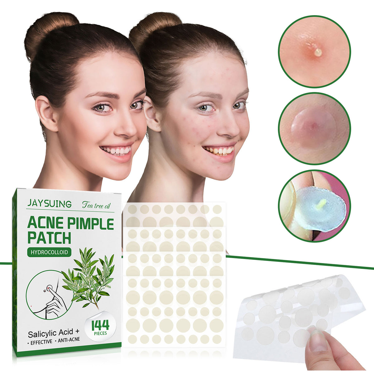 144-count pimple patches